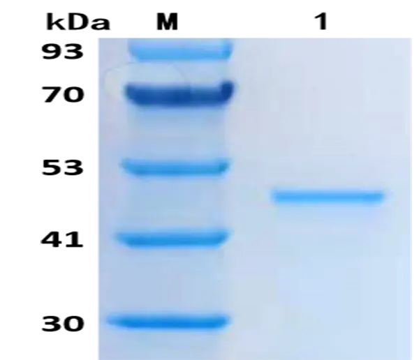 P01I0053 Human Interleukin 1β (IL 1β) Protein, Recombinant