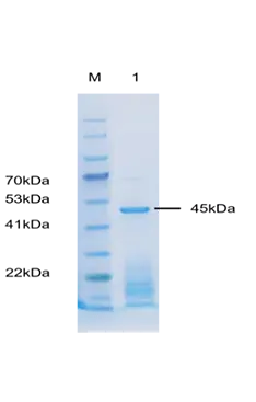 P01I0010 Human Interleukin 1β (IL-1β) Protein, Recombinant