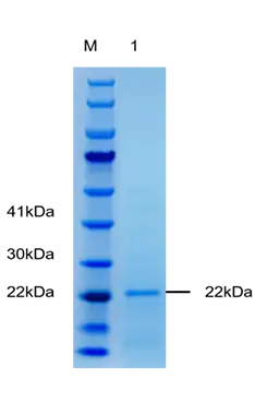 P01T0008 Human Tumor necrosis factor alpha (TNF-α) Protein, Recombinant