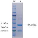 P01I0310 Human Interleukin 18 (IL-18) Protein, Recombinant