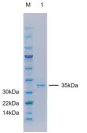 P01I0352 Human Interleukin 11 (IL-11) Protein, Recombinant