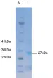 P01I0357 Human Interleukin 15 (IL-15) Protein, Recombinant