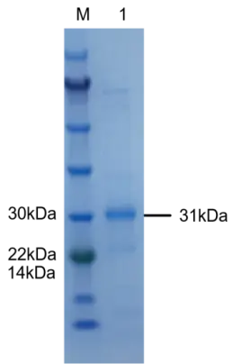 P01I0010P-T Human Interleukin 1β (IL-1β) Protein, Recombinant