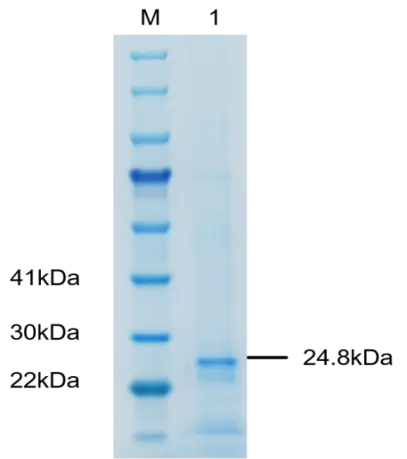 P01I0056P-T Human Interleukin 8 (IL-8) Protein, Recombinant