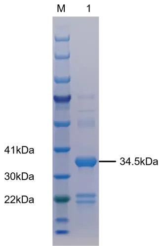 P01I0310P-T Human Interleukin 18 (IL-18) Protein, Recombinant