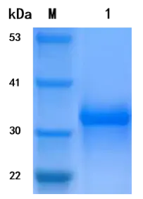 P01I0345P-T Human Interferon gamma (IFNγ) Protein, Recombinant