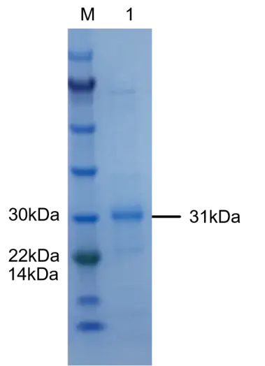 P01I0010P Human Interleukin 1β (IL-1β) Protein, Recombinant