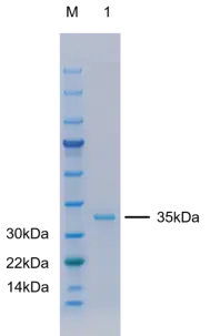 P01I0352P-T Human Interleukin 11 (IL-11) Protein, Recombinant