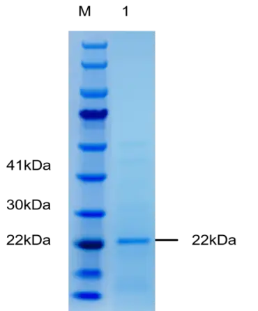 P01T0008P Human Tumor necrosis factor alpha (TNF-α) Protein, Recombinant